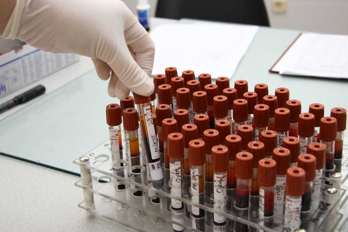 Premieră națională în tratamentul pacienților cu boli hematologice maligne 