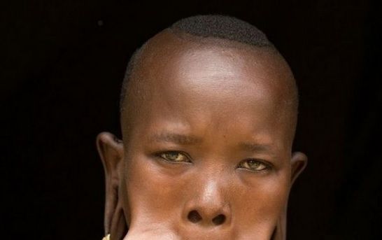 Aceasta este femeia care trăieşte cu o FARFURIE în buză. Când şi-o dă jos, te îngrozeşti!