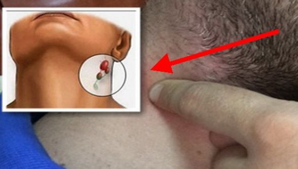 Apasă aceste puncte de pe corpul tău pentru a verifica dacă ai cancer sau bacterii