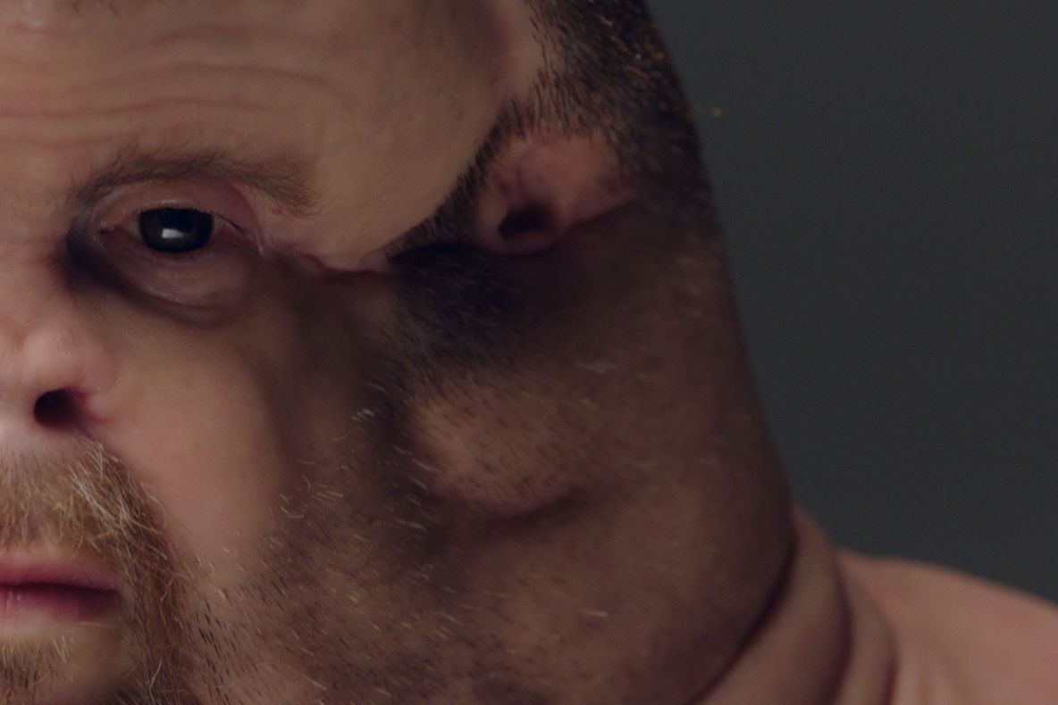 FOTO ŞOCANT: cum ar trebui să arate un om pentru a supravieţui unui accident catastrofal