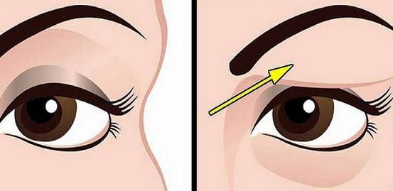 Ai pleoape căzute? Uite ce trebuie să faci