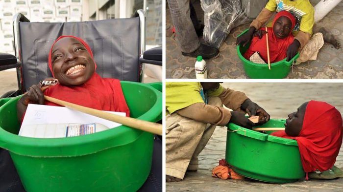 Povestea impresionantă a tinerei fără membre. Deşi trăieşte într-un lighean, este mereu veselă