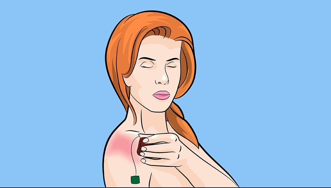 Și-a pus un pliculeț de ceai pe piele, după plajă. Efectele, peste așteptări