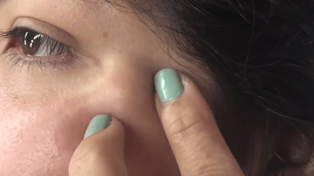 Era cea mai frumoasă din liceu, dar i-a apărut un chist pe faţă. Odată spart, iadul s-a dezlănţuit!