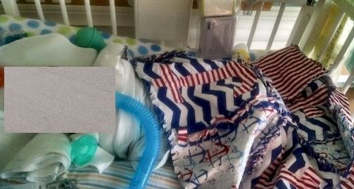 Povestea cutremurătoare a bebeluşului născut FĂRĂ nas. Când medicii l-au văzut, au plâns!