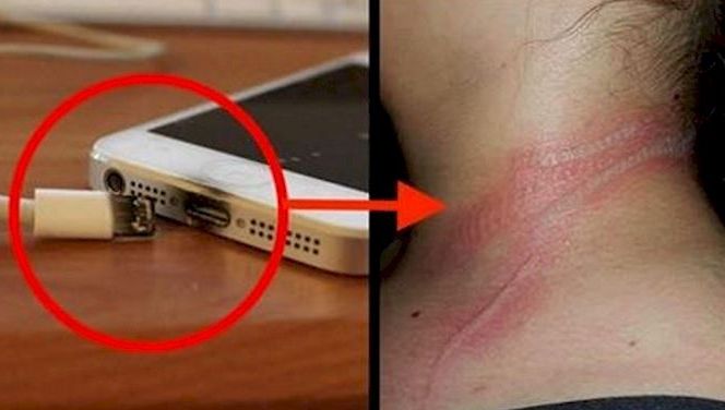 Atentie: arsuri ingrozitoare din cauza unui obiect pe care si tu il folosesti