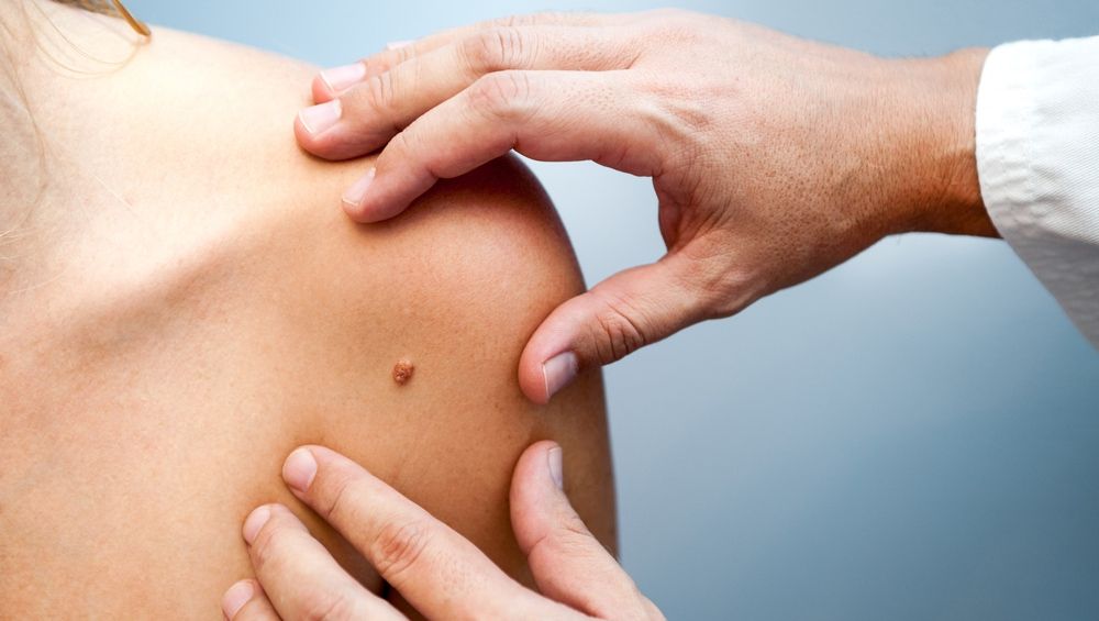 Ce se întâmplă dacă rupi o alunită. Este mai rău decât crezi