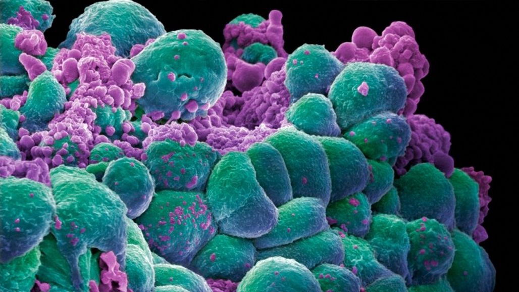 Nimeni nu ti-a spus asta pana acum! Cele mai comune cauze ale cancerului sunt ascunse oamenilor