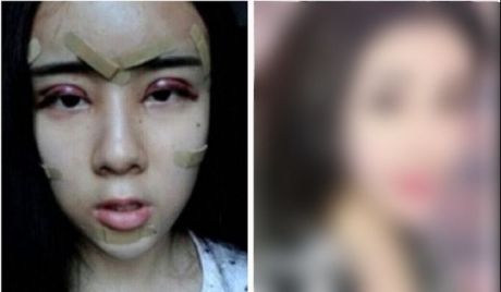 Are 15 ani și a apelat la operații estetice ca să-și recâștige iubitul. E incredibil cum arată acum