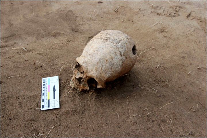 Au găsit un craniu în pământ. Când au cercetat atent, au încremenit. Ce se vedea pe el