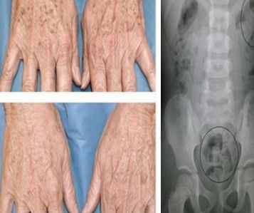 Scapă de petele de bătrâneţe şi de durerile musculare cu un singur produs natural 