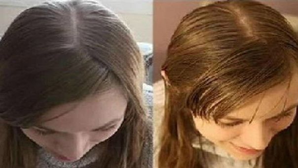 Nu s-a spălat pe cap timp de 30 de zile. A rămas surprinsă. Iată cum arată parul ei!