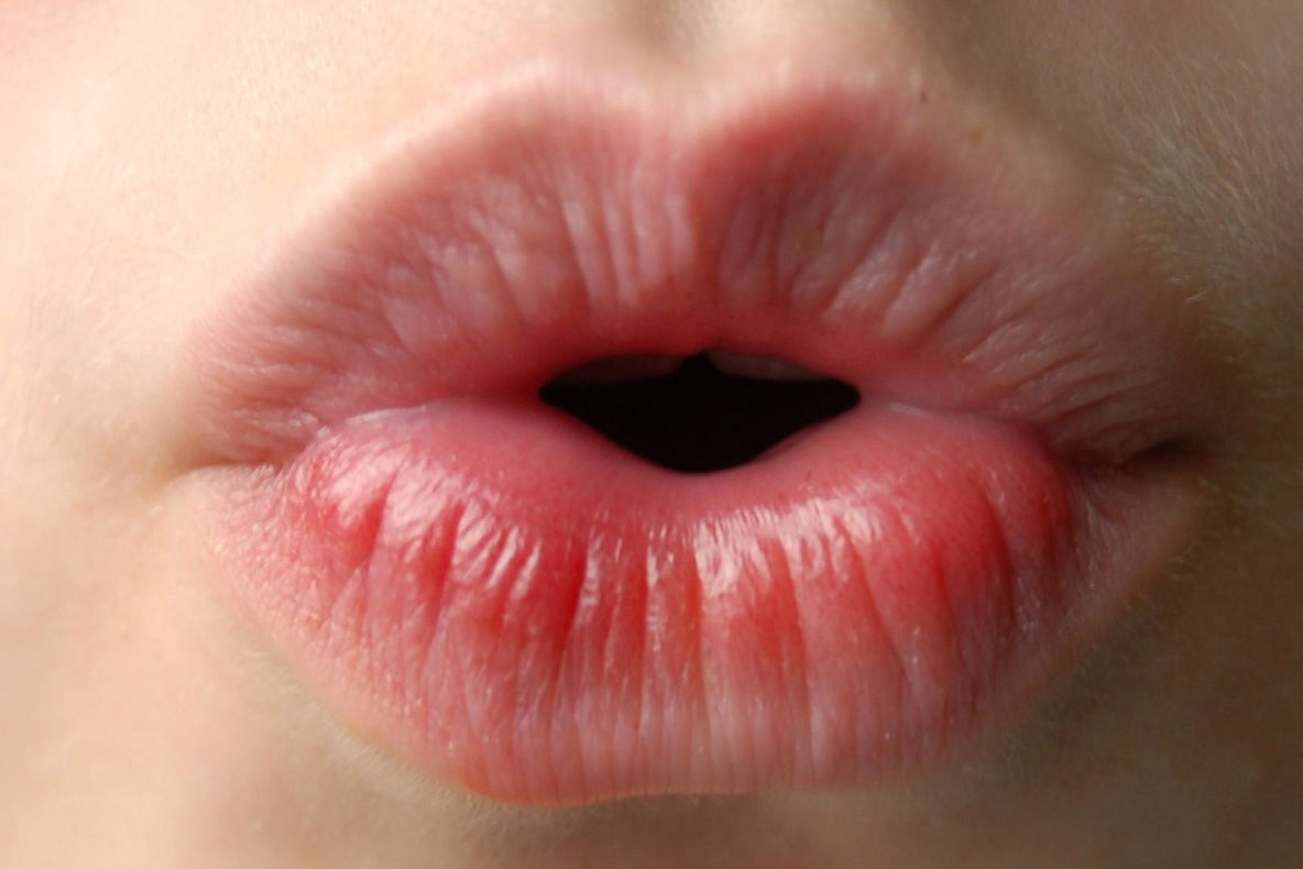 De ce ni se crapă de fapt buzele? Medicii trag un semnal de alarmă 