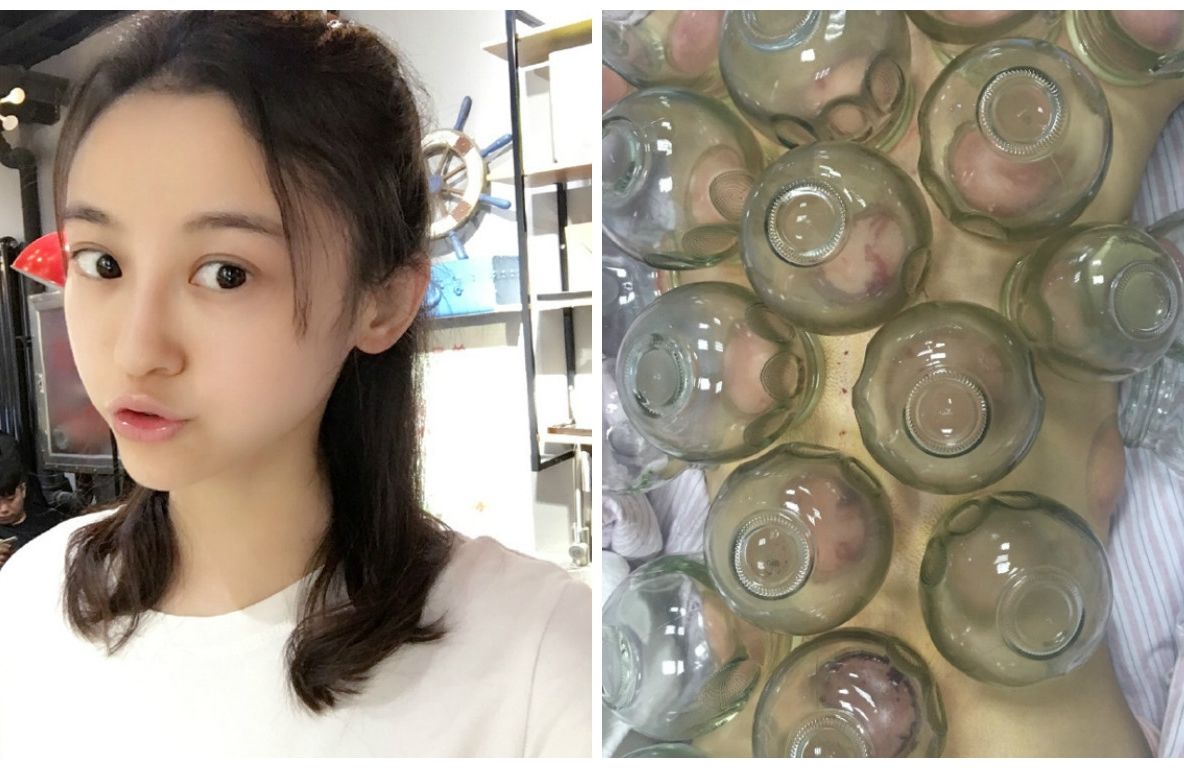 Bolnavă de cancer, a ales un remediu tradițional chinez în locul chimioterapiei. După o lună, șoc.. 