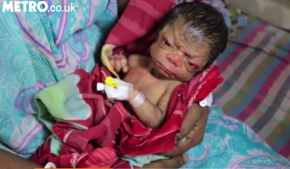 S-a născut acum 5 zile, dar arată de 80 de ani. Lecția de viață a părinților e sfâșietoare