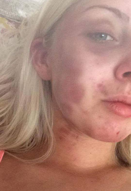 Gestul care au şocat întrega lume! Ce a făcut o tânără după ce iubitul ei a bătut-o cu bestialitate