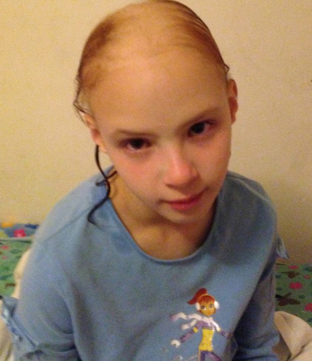 A rămas fără păr pe cap la doar 10 ani. Motivul? Greșeala pe care mulți părinți o fac