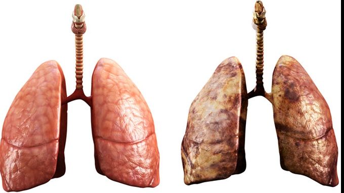 Alimentul delicios care îți curăță plămânii. Este un medicament natural