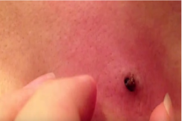 ORIBIL! Şi-a spart un coş pe care îl avea de 20 de ani. GROAZNIC! Ce a ieşit de acolo