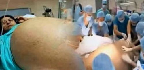 Au crezut că va naşte cel puţin gemeni, dar la asta nu se aşteptau. Ce se ascundea în burta femeii?