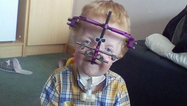 Când s-a născut, medicii nu i-au dat nicio şansă la viaţă. Acum este optimist copil din lume