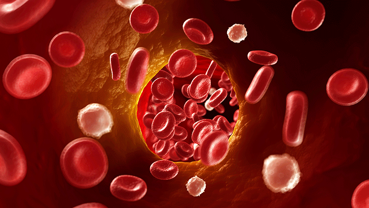 "Stop Trombozei, salvează vieți" - 13 octombrie, Ziua Internațională a Trombozei