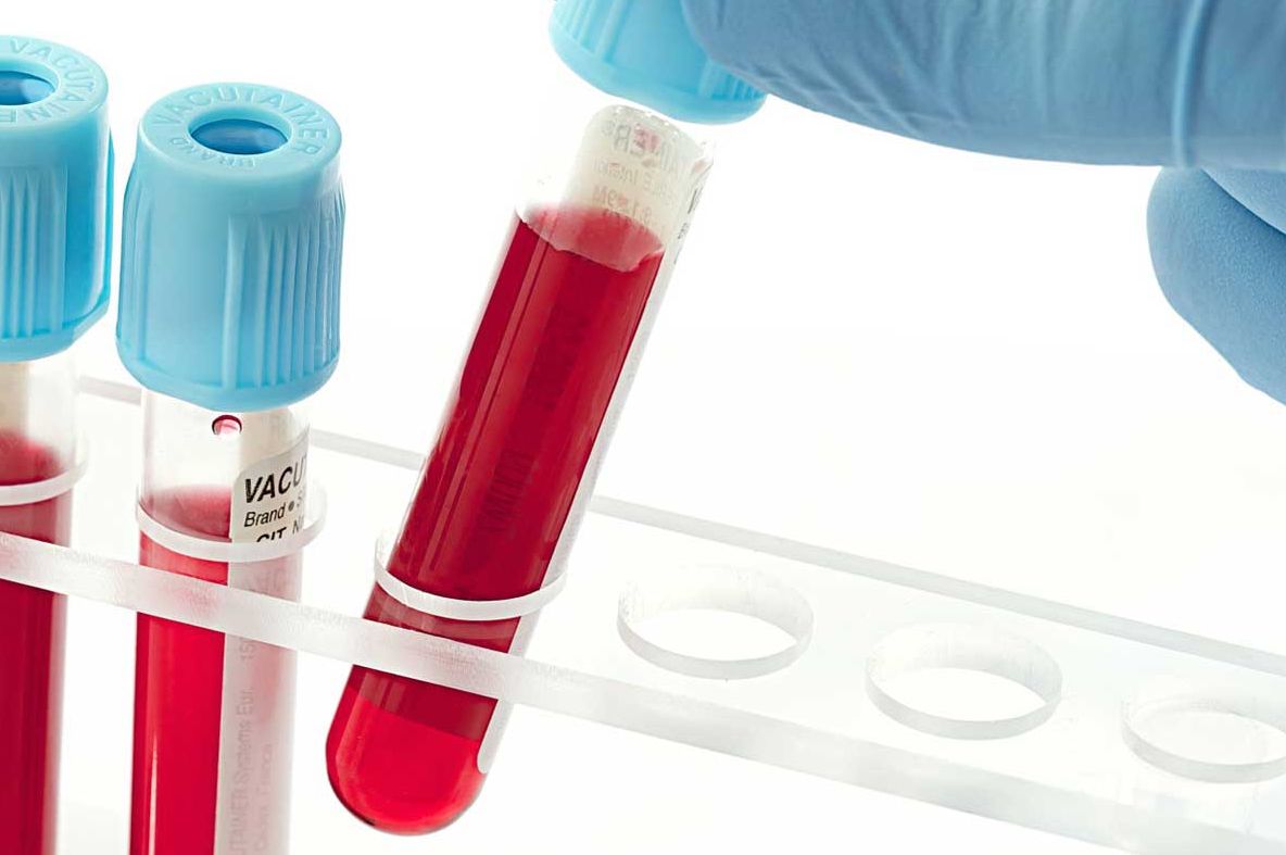 Cancerul și bolile de inimă apar, mai ales, la cei cu această grupă de sânge