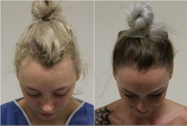 Îţi prinzi părul aşa? Nu vei mai face asta după ce vei citi ce a păţit această balerină