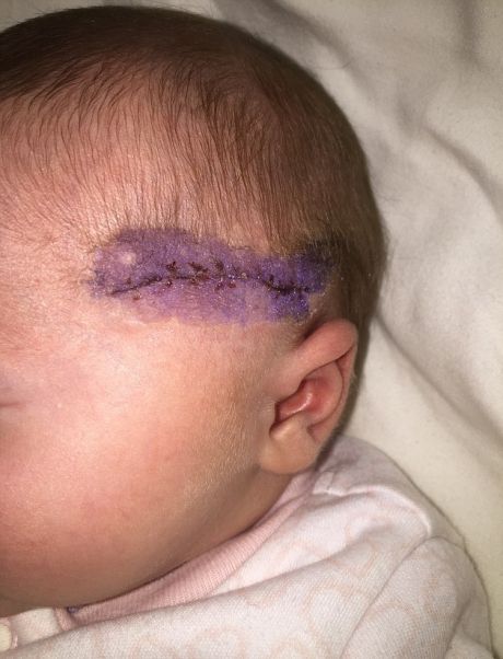 Adevărul şocant din spatele acestei fotografii. Ce are, de fapt, bebeluşul din imagine