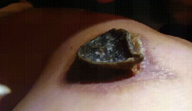 DUREROS! A fost muşcat de un raton, în pădure. Şi-a RUPT coaja de la rana creată. Ce era dedesubt