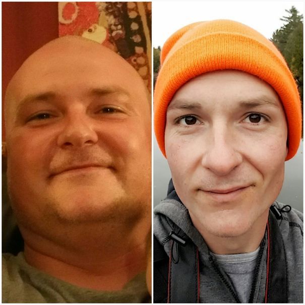 Efectele devastatoare ale alcoolului. 9 imagini tulburătoare care îţi vor schimba viaţa  