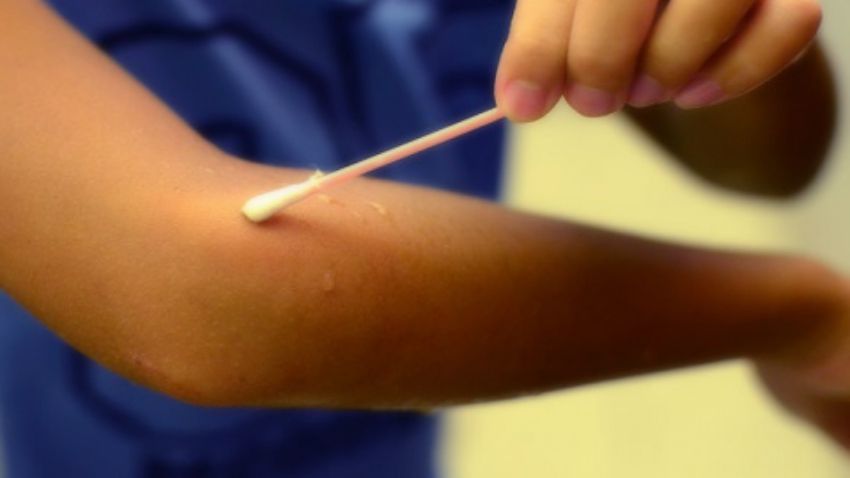 Acest test simplu îţi arată dacă ai deficit de iod în organism!