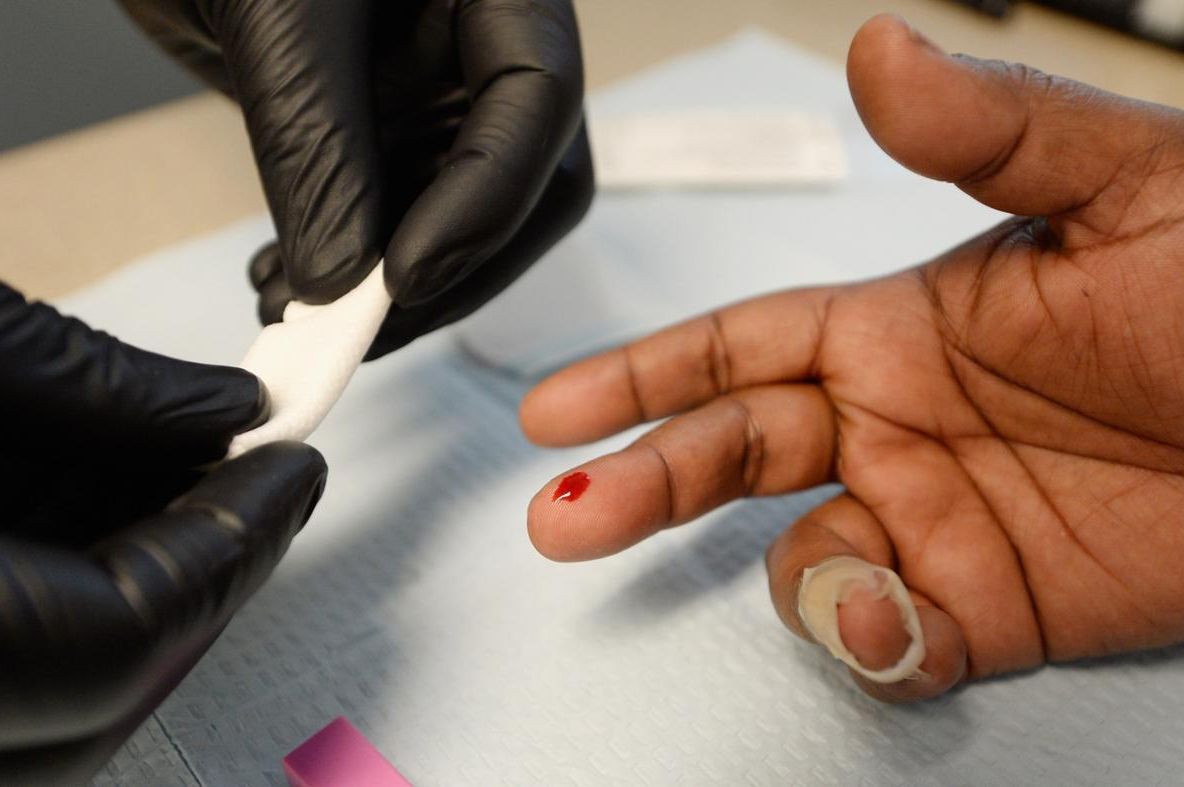 Şase semne surprinzătoare care îţi spun că ai virusul HIV