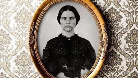 Povestea şocantă din spatele acestei imagini. Cine este tânăra cu semnele misterioase pe faţă?