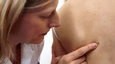 Trei tipuri de cancer care recidivează mai des