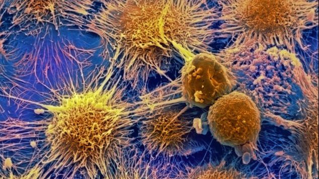 Singurul fruct care poate preveni și lupta cu toate tipurile de cancer