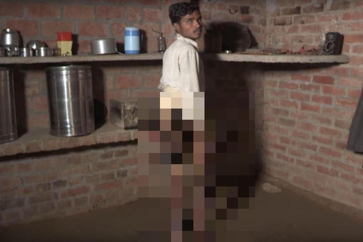 Bărbatul cu 4 picioare. Povestea impresionantă a tânărului care s-a săturat să arate ca un MONSTRU