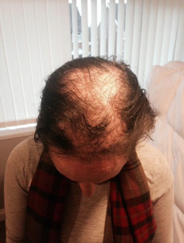 Au poreclit-o "mireasa cheală". Avea ticul de a-şi smulge părul. Ce cadou i-a făcut mirele. A PLÂNS!