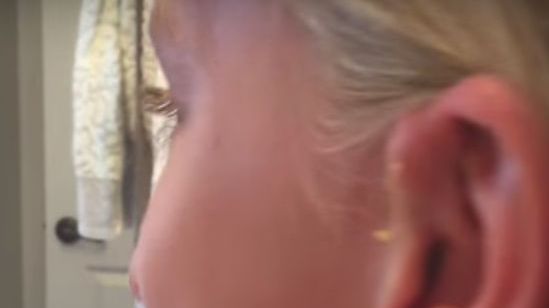 A trăit 6 ani cu o umflătură pe ureche. La un moment dat a erupt: "Dumnezeule, ce-i asta??"