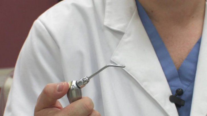 De frica dentistului, şi-a lipit singură dinţii cu super glue. Cum arată dantura femeii acum