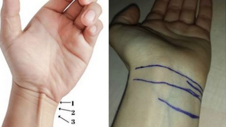 Numărul lor îți arată când vei muri. Tu câte linii ai la încheietura mâinii?