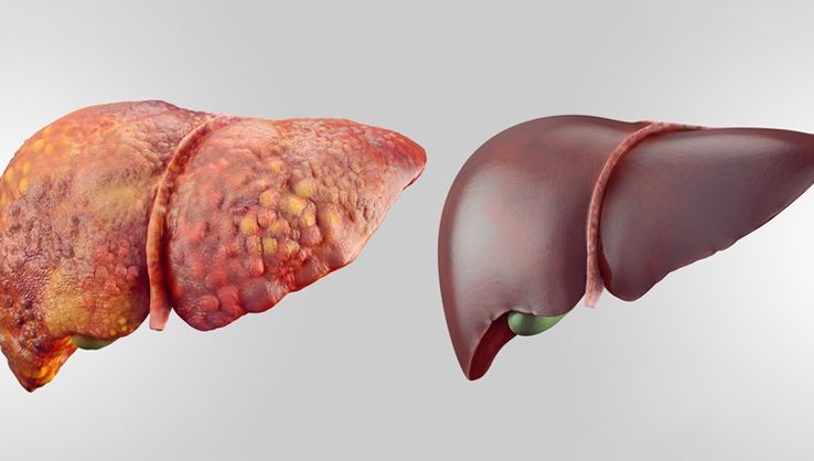 Ingredientul bizar pe care să-l adaugi în apa plată pentru detoxifierea ficatului