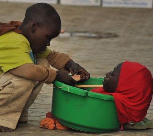 Tânăra fără membre, care trăia într-un lighean, a murit de Crăciun