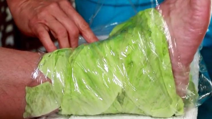 Şi-a înfăşurat câteva foi de varză pe genunchi şi glezne. A rămas uimită când a vazut ce efect are