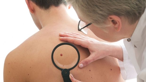 E periculos dacă ți-ai rupt o aluniță? Iată ce trebuie să faci