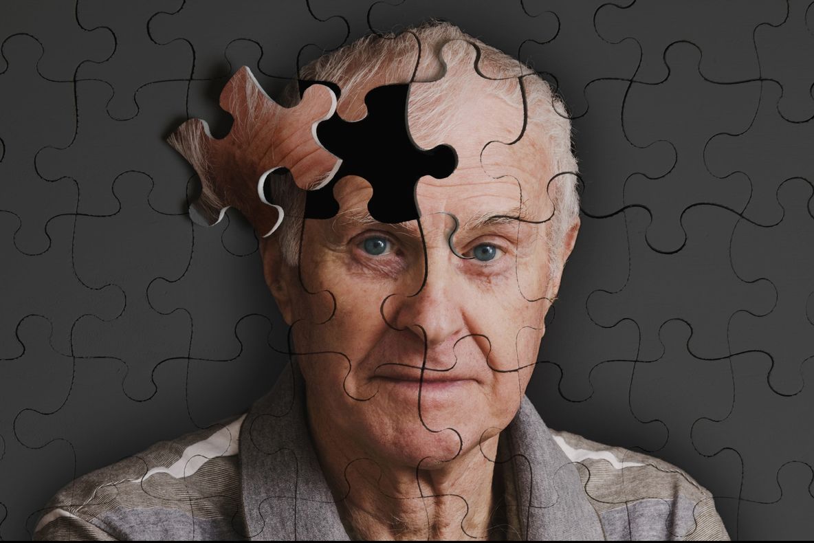 Legătura dintre somn și Alzheimer. De câte ore de somn ai nevoie ca să nu-ți pierzi memoria?