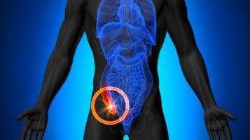 Deşi era considerat inutil, apendicele are un rol esenţial. Ne poate salva viaţa