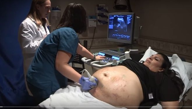 Avea o burtă imensă plină de vânătăi. La ecografie, medicii au înlemnit. Ce era, de fapt