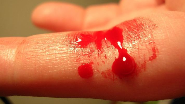 Ce înseamnă când visezi sânge