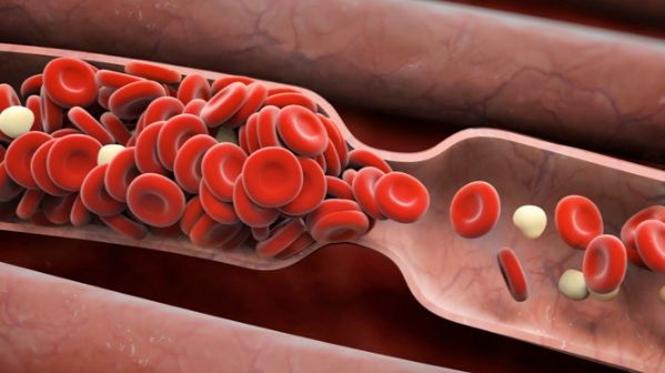 Fructul care previne formarea cheagurilor de sânge şi reduce riscul de accident vascular cerebral 